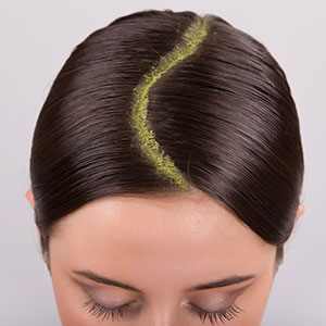 organic scalp treatment